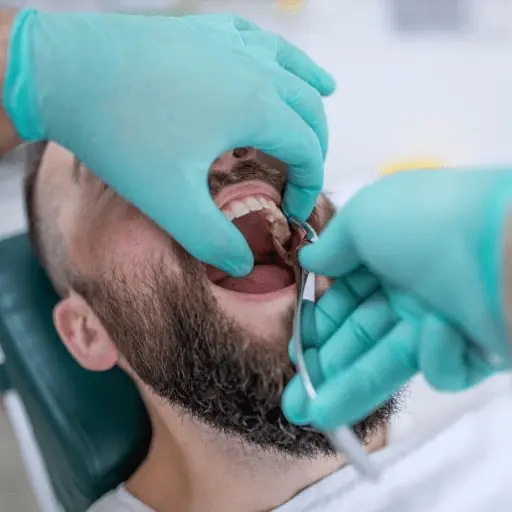 Extracción Dental Lanzarote